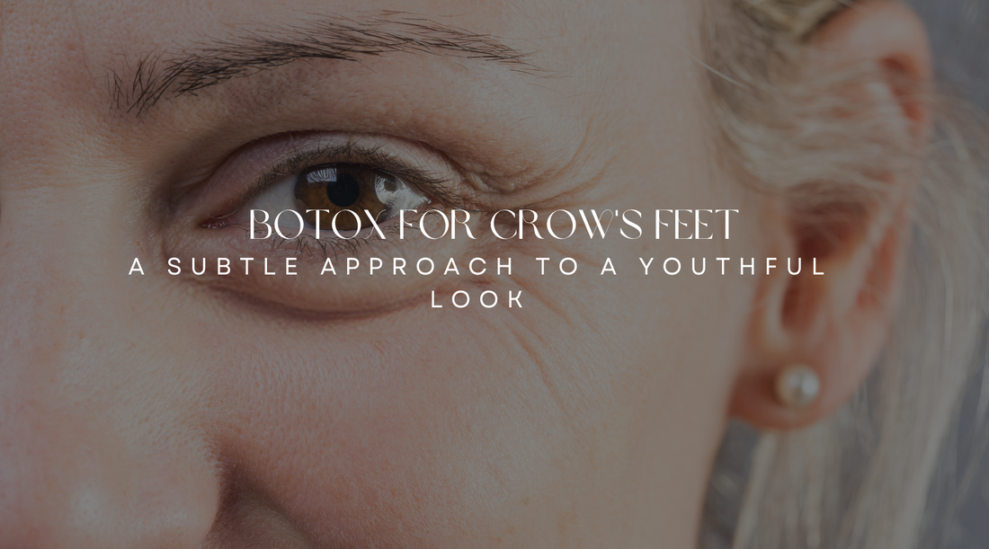 Botox for Crow's Feet: A Subtle Approach to a Youthful Look