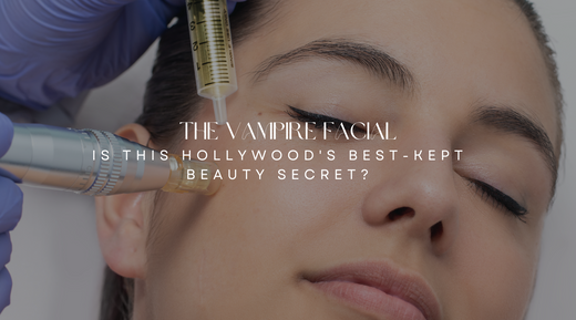 The Vampire Facial: Is This Hollywood's Best-Kept Beauty Secret?