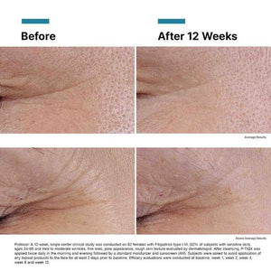 SkinCeuticals P-TIOX - BotoxBarb