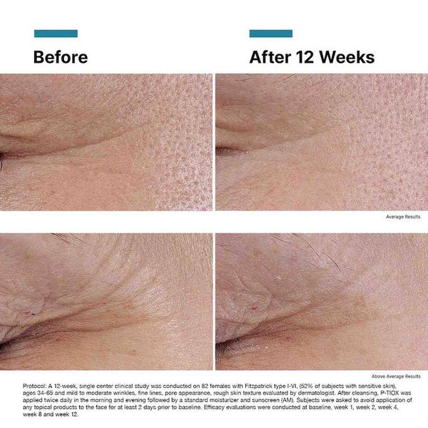 SkinCeuticals P-TIOX - BotoxBarb