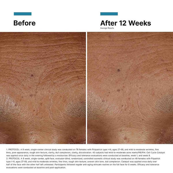 SkinCeuticals Hyaluronic Acid Intensifier Multi-Glycan - BotoxBarb 