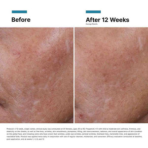 SkinCeuticals Hyaluronic Acid Intensifier Multi-Glycan - BotoxBarb 