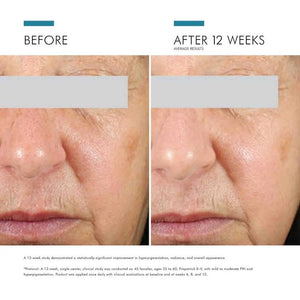 SkinCeuticals Daily Brightening UV Defense Sunscreen SPF 30 - BotoxBarb 